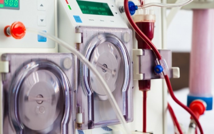 Βόλος: Προς επίλυση το θέμα της προμήθειας φίλτρων αιμοκάθαρσης