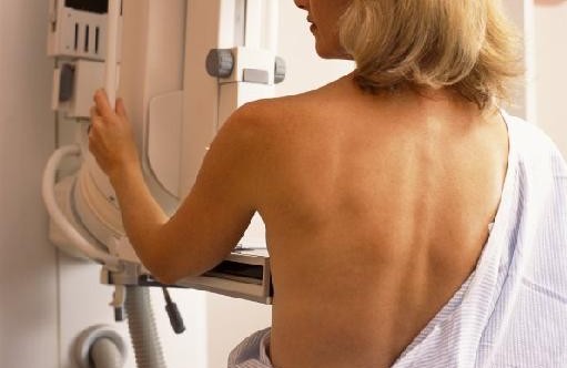 Δράμα: Κινητή Μονάδα Μαστογράφου στο Παρανέστι