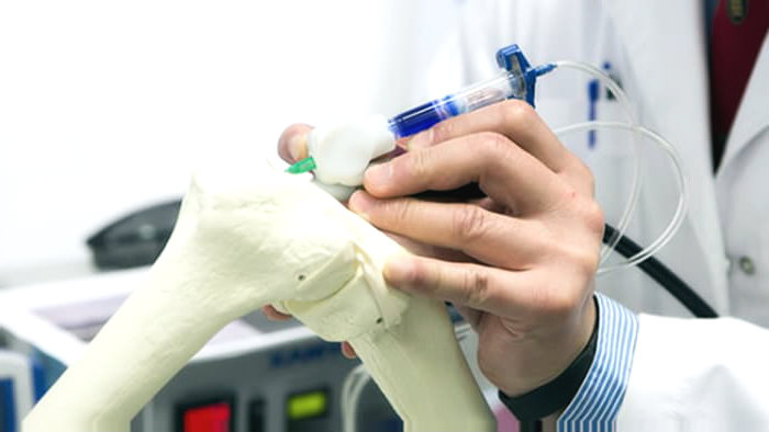 3D πένα επιτρέπει σε χειρουργούς να εκτυπώνουν εμφυτεύματα εν μέσω εγχειρήσεων