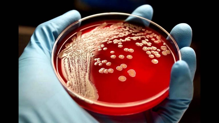 Κώδωνας κινδύνου για τα υπερανθεκτικά μικρόβια