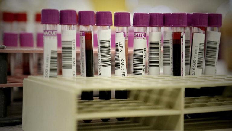 Ορεστιάδα: Εθελοντικές αιμοδοσίες από τον «Άγιο Παντελεήμωνα»