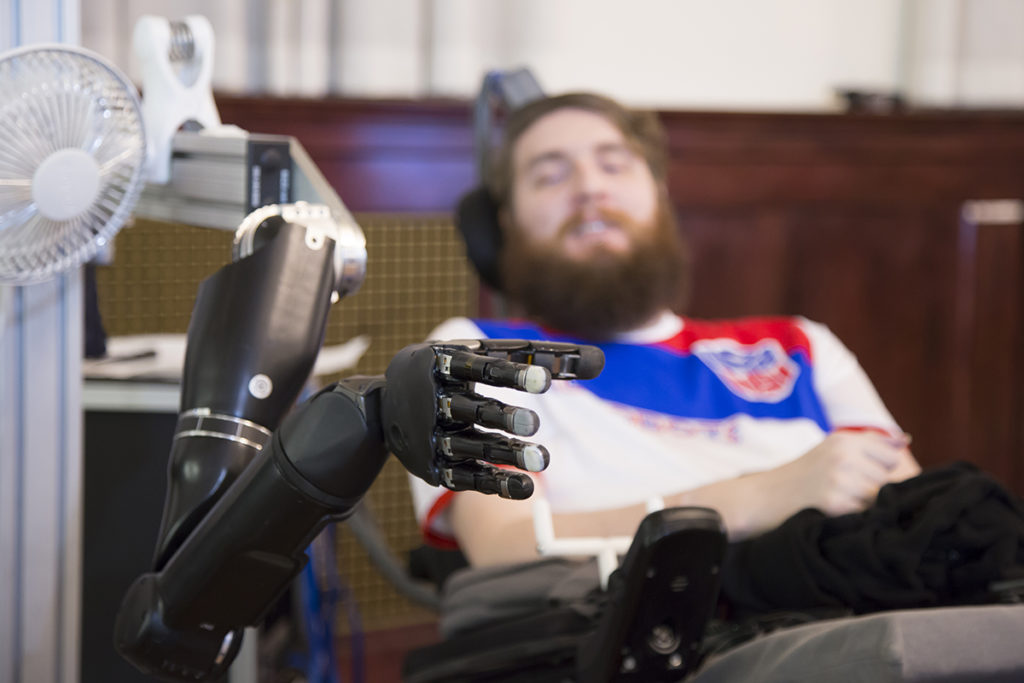 Παράλυτος απέκτησε αίσθηση αφής στο ρομποτικό χέρι του χάρη σε εγκεφαλικά τσιπάκια