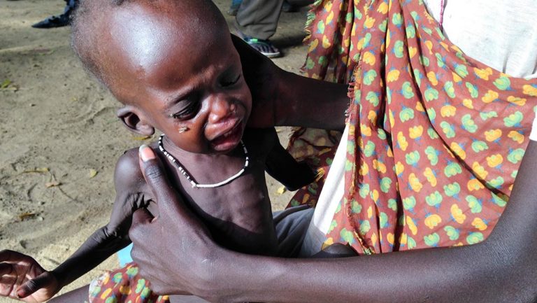 Γιατροί Χωρίς Σύνορα: Καμπάνια για τον παιδικό υποσιτισμό