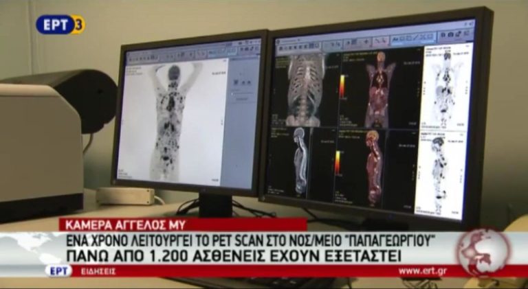 Ένα χρόνο λειτουργεί το pet scan στο νοσοκομείο Παπαγεωργίου (video)