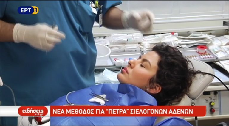 Νέα μέθοδος θεραπείας για την πέτρα στους σιελογόνους αδένες (video)