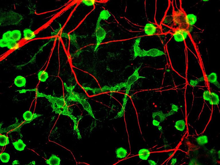 Νέα μέθοδος μεταμορφώνει το ανθρώπινο δέρμα σε εγκεφαλικά κύτταρα
