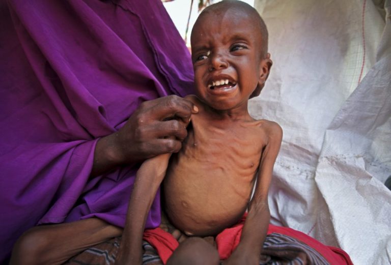 Οξύ πρόβλημα υποσιτισμού για περίπου 1,4 εκατομμύρια παιδιά στη Σομαλία