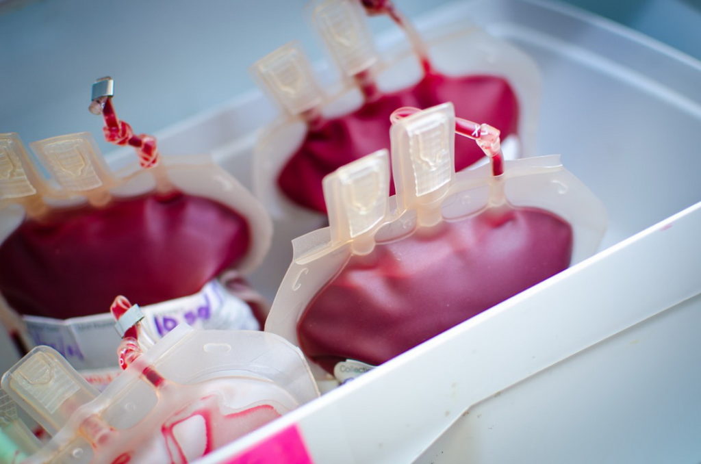 Κέρκυρα: Δεν υπάρχει έλλειψη αίματος στο νοσοκομείο λέει η διοίκηση