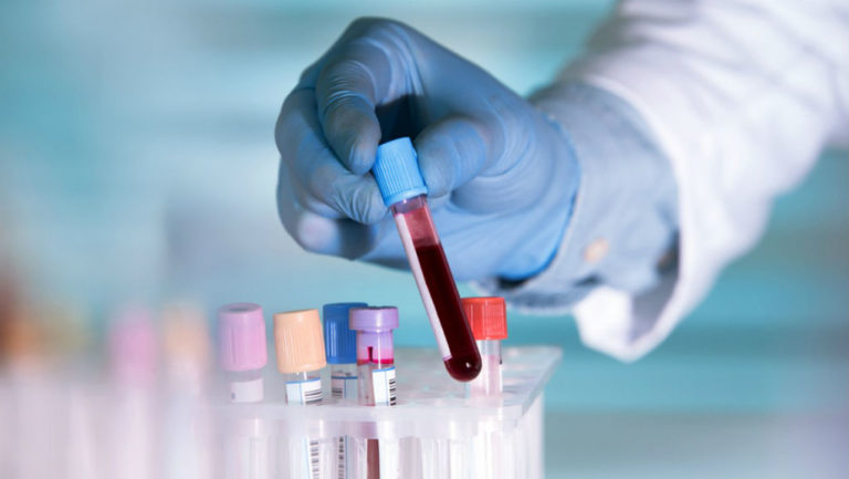 Διάγνωση καρκίνου με νέο τέστ αίματος που ανιχνεύει γενετικές μεταλλάξεις