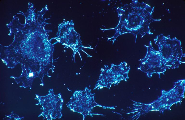 Επιστήμονες δίνουν στοιχεία για τις μεταλλάξεις που μπορεί να σχετίζονται με την εμφάνιση καρκίνου
