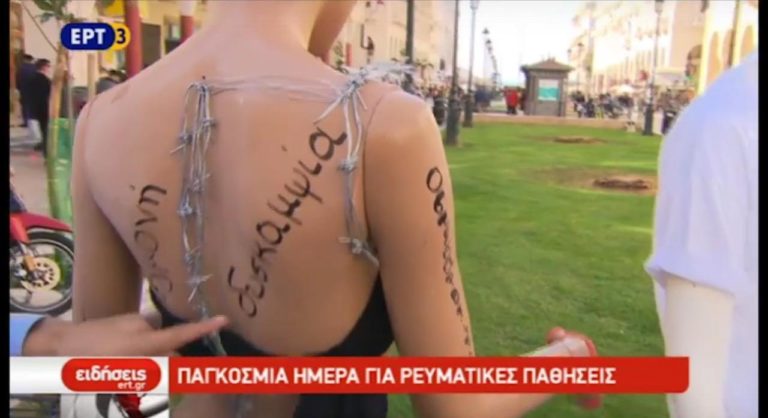 Περίπου 3 εκατομμύρια Έλληνες πάσχουν από ρευματικές παθήσεις (video)