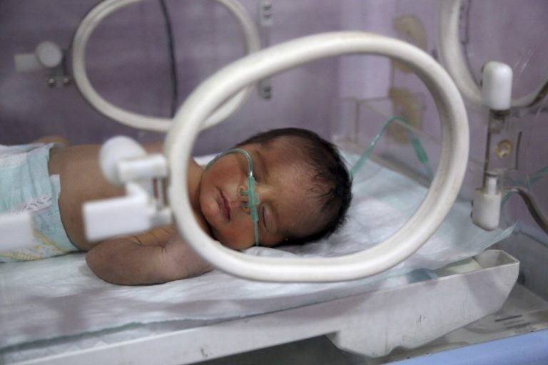 Γεννήθηκε βρέφος με την καρδιά έξω από το σώμα και επέζησε