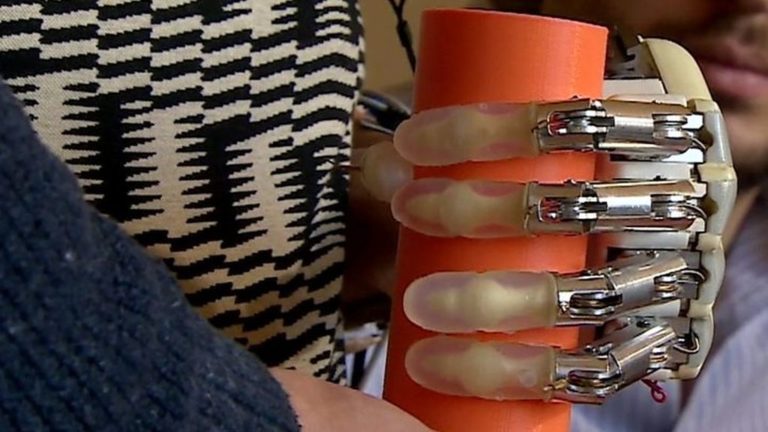 Βιονικό χέρι με αίσθηση αφής μπορεί να χρησιμοποιηθεί και εκτός εργαστηρίου