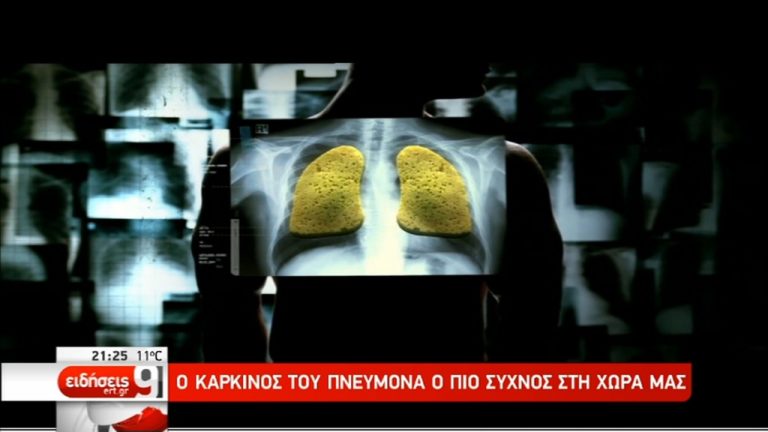Ο καρκίνος του πνεύμονα είναι η πιο συχνή μορφή της νόσου στην Ελλάδα (video)
