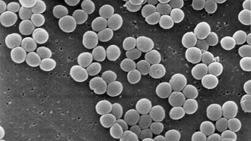 Ανακάλυψαν πάνω στο δέρμα βακτήριο -“ασπίδα” απέναντι στις νεοπλασίες