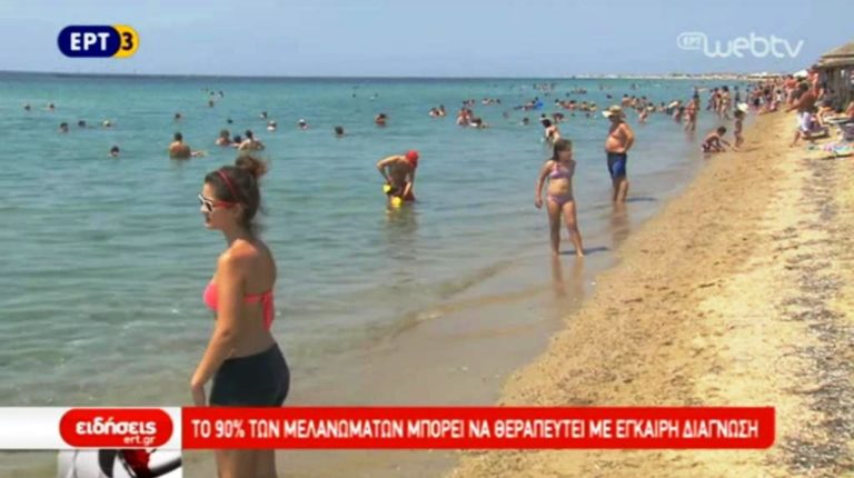 To 90% των μελανωμάτων μπορεί να θεραπευτεί με έγκαιρη διάγνωση (video)