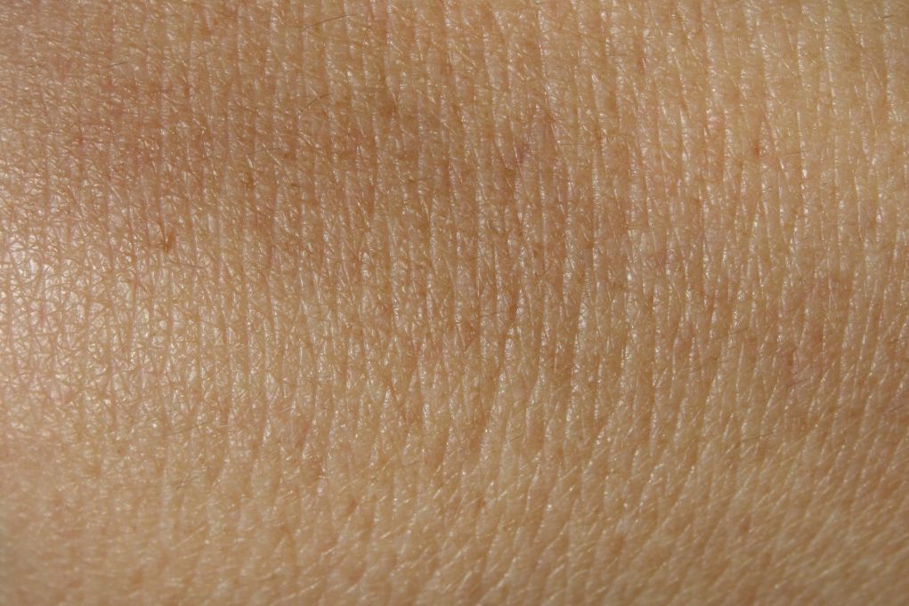 Ανοιχτά τραύματα μετατρέπονται απευθείας σε υγιές δέρμα χάρη σε νέα τεχνική