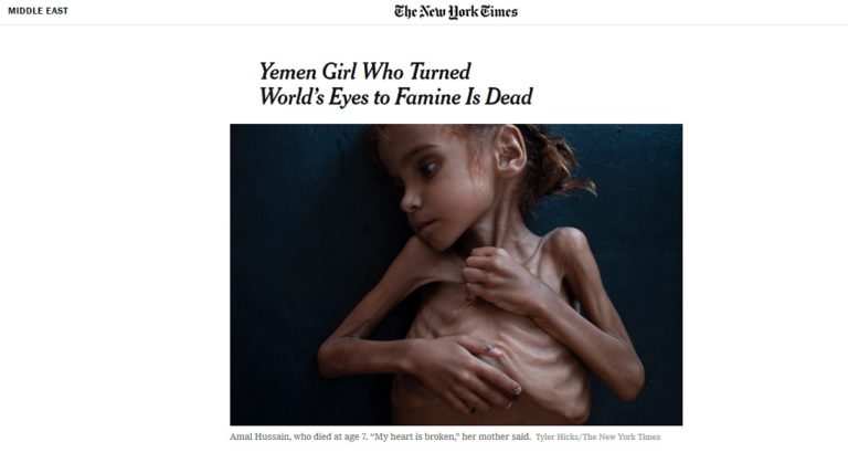 Πέθανε η επτάχρονη Αμάλ, σύμβολο του λιμού στην Υεμένη