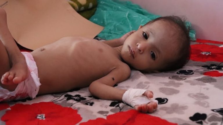 Unicef: Οι επιπτώσεις του κορονοϊού απειλούν 1,2 εκατ.  παιδιά σε φτωχές χώρες