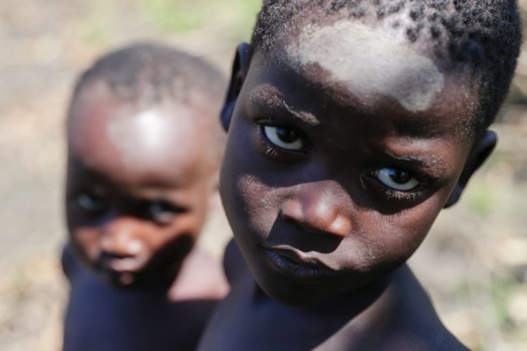 Μοζαμβίκη: Στα 139 αυξήθηκαν τα κρούσματα χολέρας