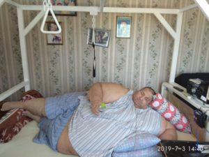 Κομοτηνή: Ένας υπέρβαρος άνθρωπος «φυλακισμένος» στο ίδιο του το σώμα