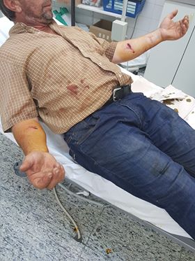 Εορδαία: Aδέσποτος σκύλος επιτέθηκε σε γυναίκα και παιδί