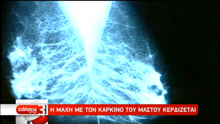 H έγκαιρη διάγνωση του καρκίνου του μαστού σώζει ζωές  (video)