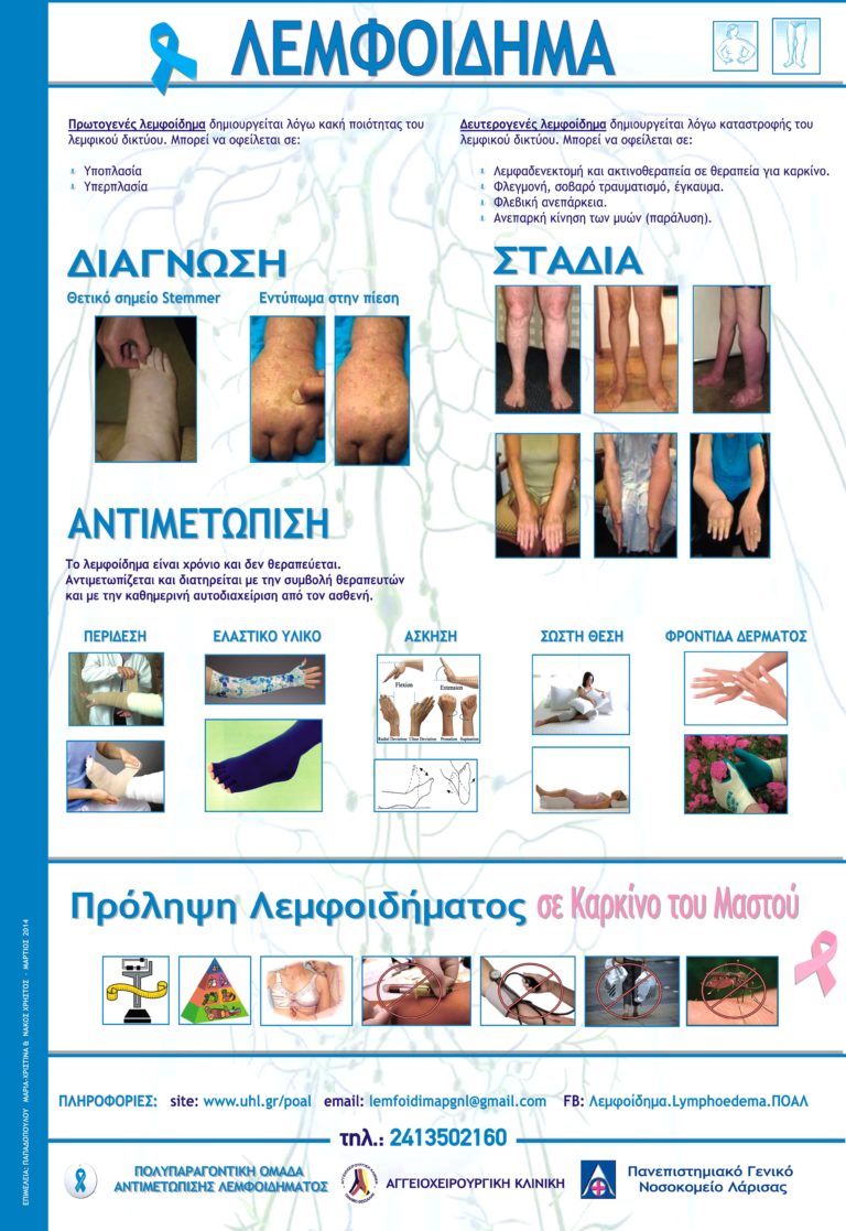 Ημέρα Ενημέρωσης για το Λεμφοίδημα