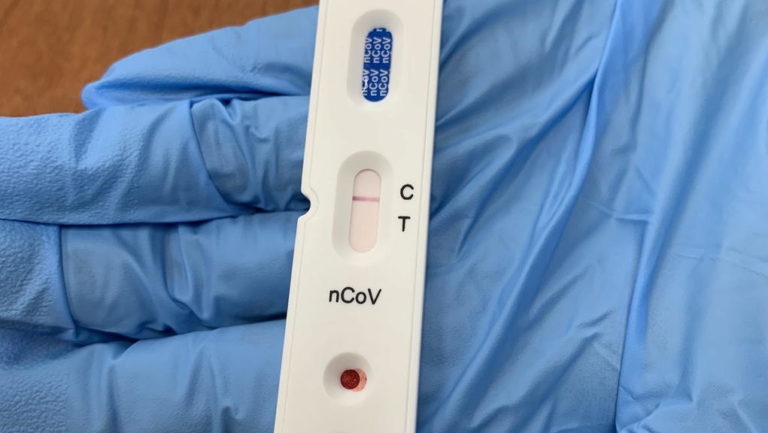 Covid-19: Τα  6 ελληνικά νοσοκομεία που συλλέγουν πλάσμα για σοβαρά νοσούντες