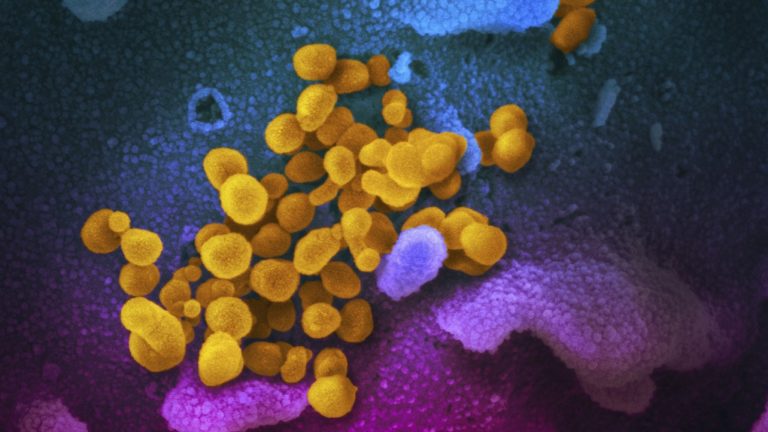 Θεσσαλία: 294 νέες μολύνσεις SARS-COV 2 – Αναλυτικοί πίνακες