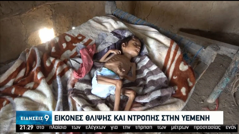 Η πιο σκοτεινή ώρα για την Υεμένη-Τα παιδιά πληρώνουν το βαρύτερο τίμημα (video)