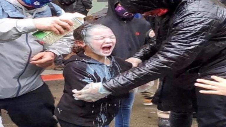 Σιάτλ: Οργή για τον τραυματισμό 7χρονου με χημικά σε διαδηλώσεις κατά του ρατσιμού (video)