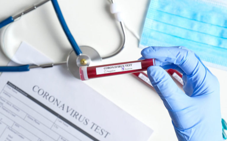 Αν. Μακεδονία-Θράκη: 33 νέες μολύνσεις SARS-COV 2 – Αναλυτικοί πίνακες