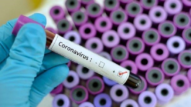 Ήπειρος: 25 νέα κρούσματα COV-SARS 2 – Αναλυτικοί πίνακες