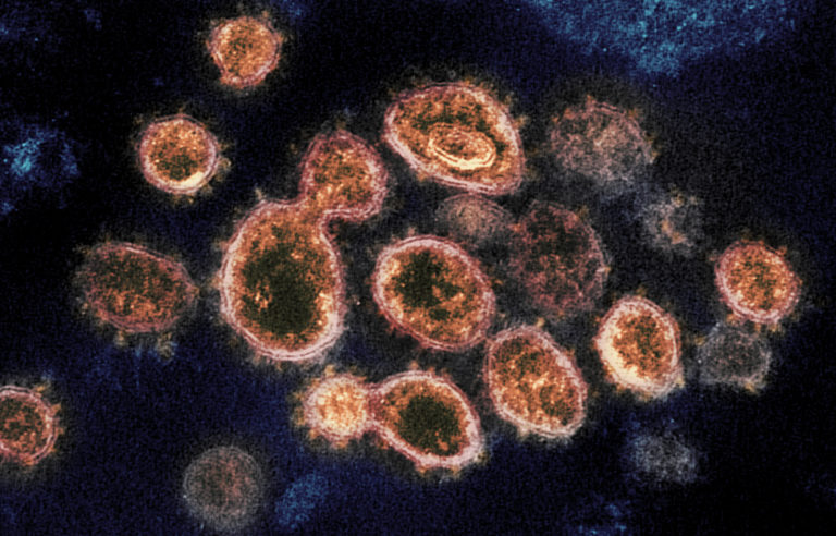 Θεσσαλία: 241 νέες μολύνσεις SARS-COV 2 – Αναλυτικοί πίνακες