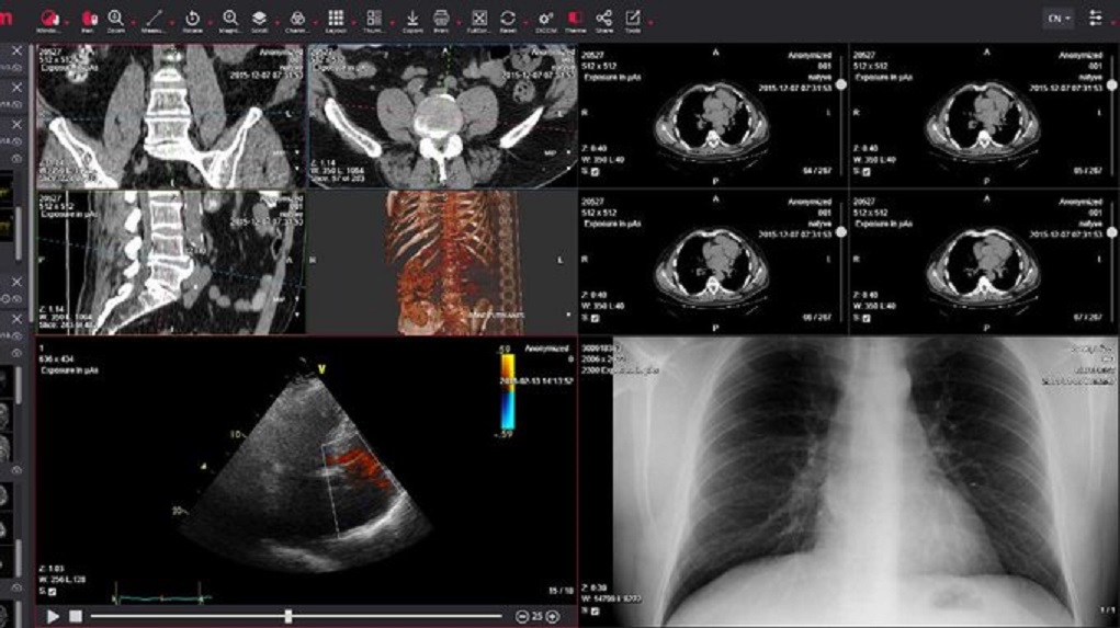 ΗΠΑ – δρ. Κατσάγγελος: Διάγνωση της Covid-19 από ακτινογραφίες πνευμόνων