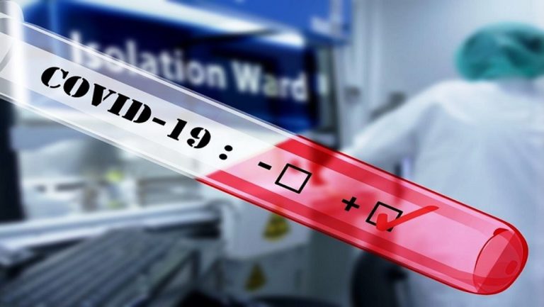 Αν. Μακεδονία-Θράκη: 77 νέες μολύνσεις SARS-COV 2 – Αναλυτικοί πίνακες