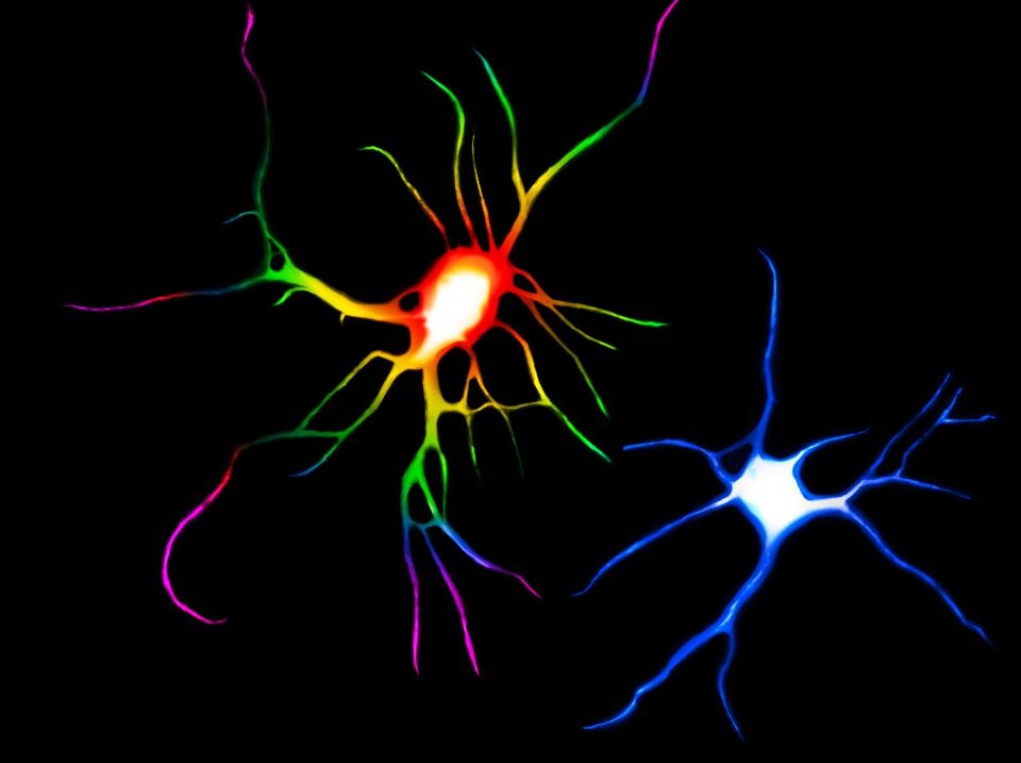 Έλληνες και Βρετανοί επιστήμονες ανακάλυψαν νέα στοιχεία για το πώς επιδρά το LSD στον ανθρώπινο εγκέφαλο