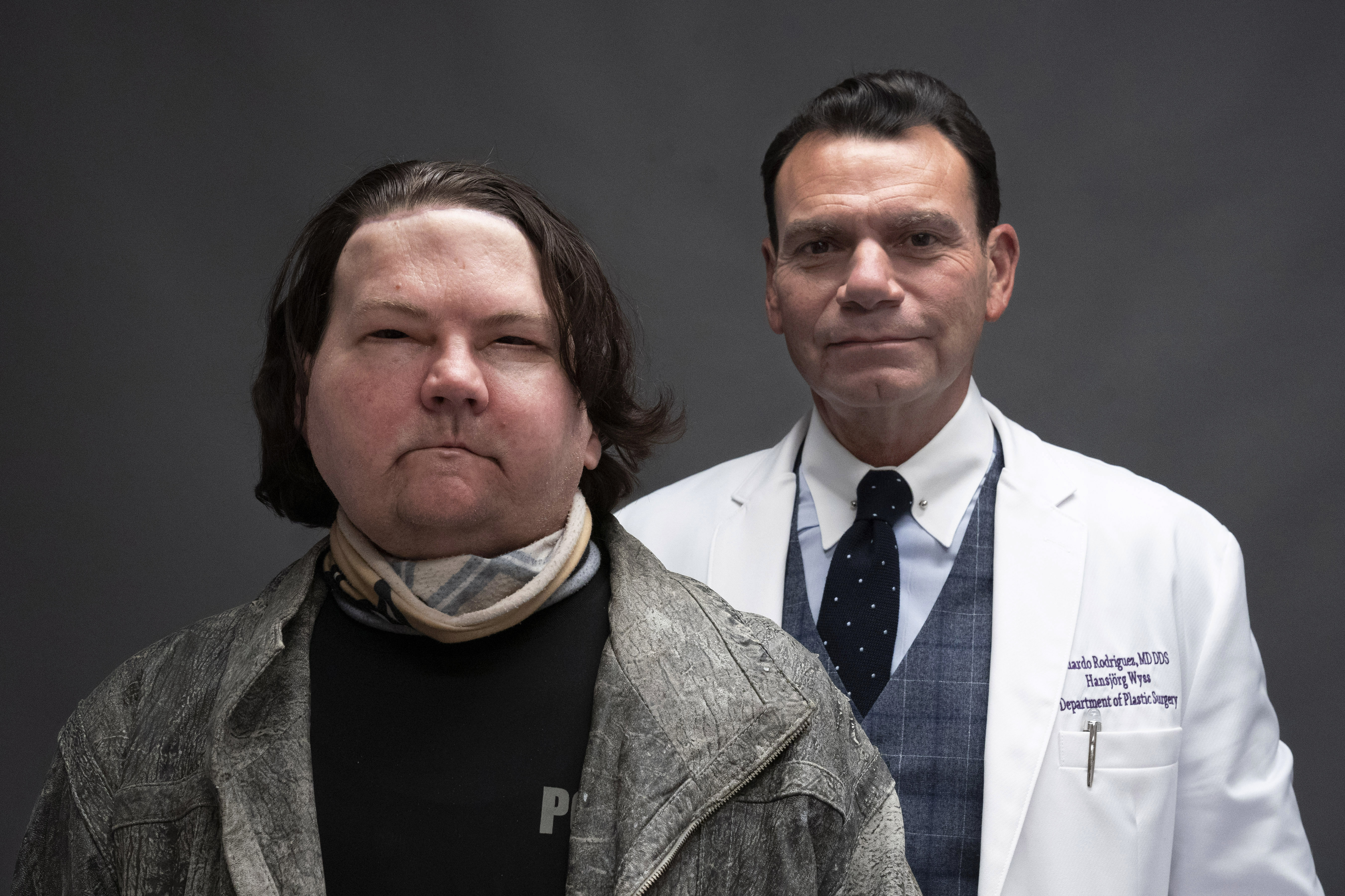Face Double Hand Transplant