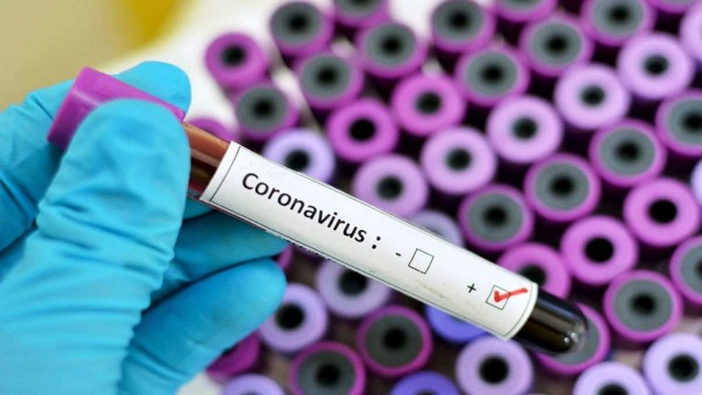 Κρήτη: 41 νέες μολύνσεις SARS-COV 2 – Αναλυτικοί πίνακες
