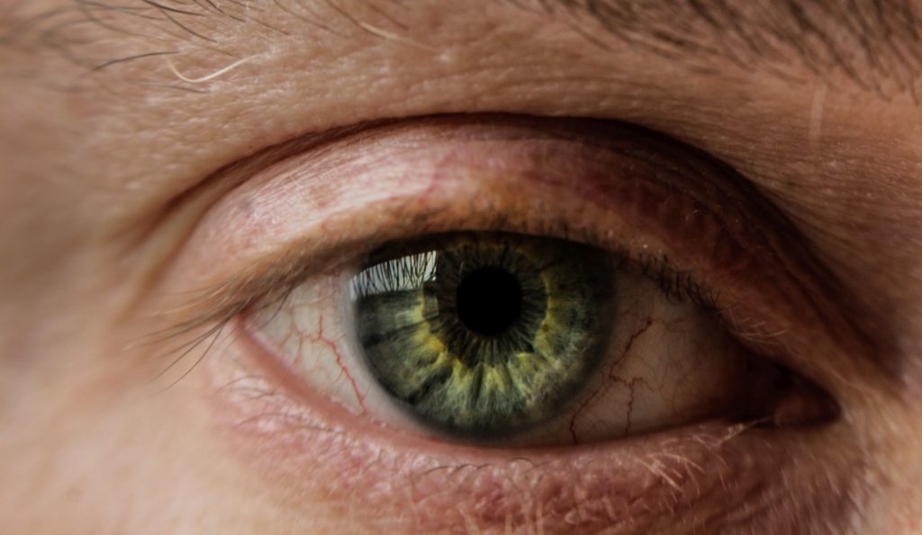 Έρευνα: Η σοβαρή Covid-19 συνδέεται με δυνητικά επικίνδυνες ανωμαλίες στα μάτια