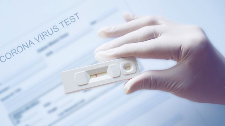 Έξι θετικά από 213 rapid tests – Συνεχίζονται οι δωρεάν έλεγχοι σε Καστοριά και Άργος Ορεστικό