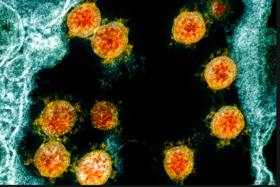 Θεσσαλία: 121 νέες μολύνσεις SARS-COV 2 – Αναλυτικοί πίνακες
