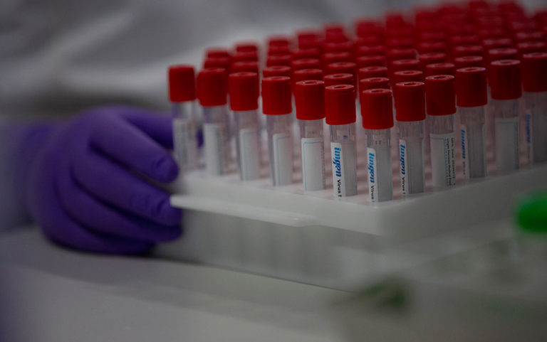 Αν.Μακεδονία-Θράκη: 16 νέες μολύνσεις SARS-COV 2 – Αναλυτικοί πίνακες