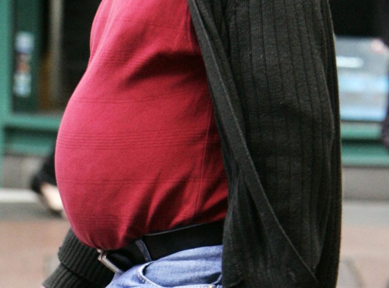 Έρευνα: Οι πολύ παχύσαρκοι ασθενείς με Covid-19 αντιμετωπίζουν 60% μεγαλύτερο κίνδυνο θανάτου εξαιτίας της νόσου