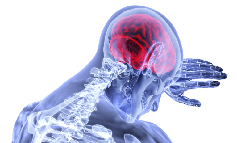 Έρευνα: Τα εγκεφαλικά αυξάνουν σημαντικά τον κίνδυνο άνοιας