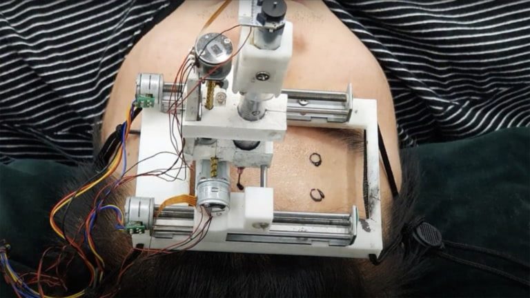 Ηλεκτρονικό τατουάζ παρακολουθεί τα εγκεφαλικά κύματα