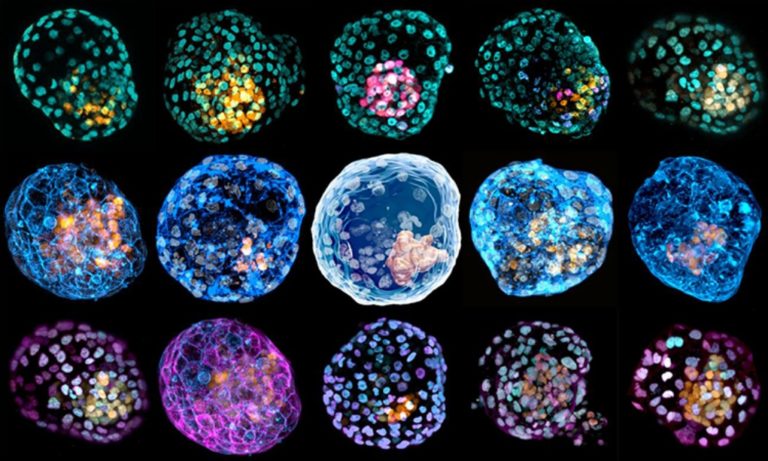 Επιστήμονες δημιούργησαν τα πρώτα μοντέλα πρώιμου ανθρώπινου εμβρύου από κύτταρα δέρματος ή βλαστοκύτταρα