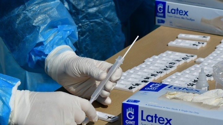 ΑΠΘ: Rapid test θα ανιχνεύει τον χρόνο μόλυνσης από κορονοϊό