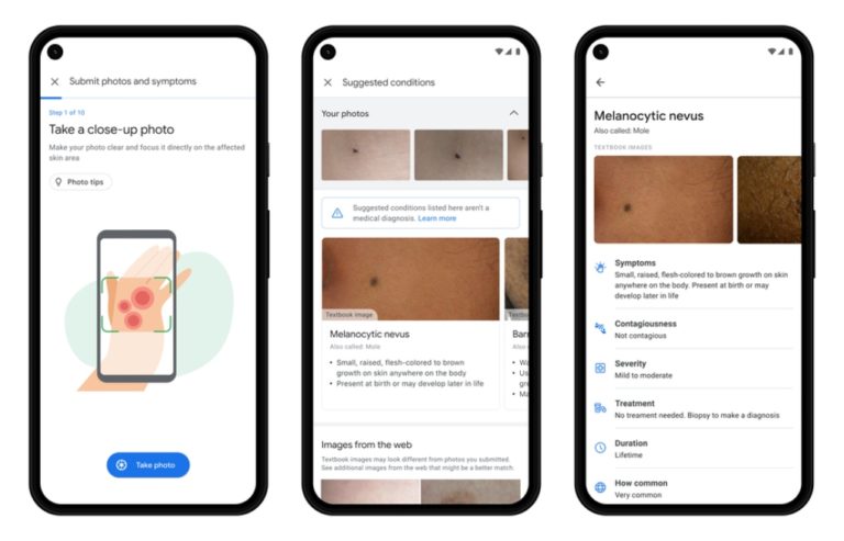 Derm Assist: Η Google παρουσίασε νέο εργαλείο τεχνητής νοημοσύνης για δερματικές παθήσεις